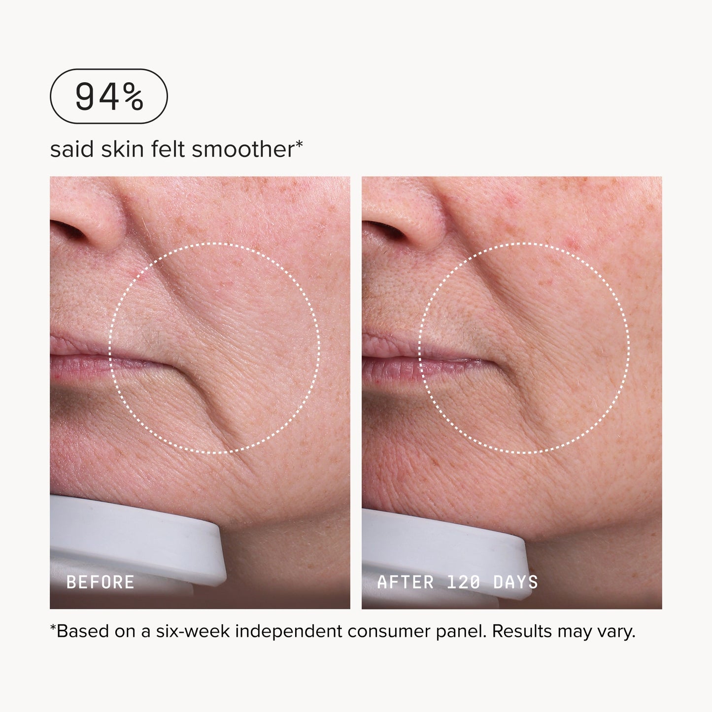 Needle-less® Serum