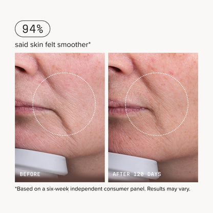Needle-less® Serum