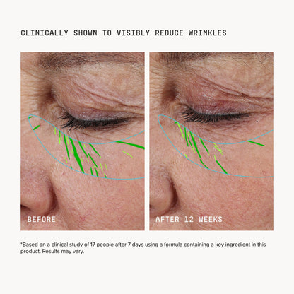 Needle-less® Growth Factor Serum
