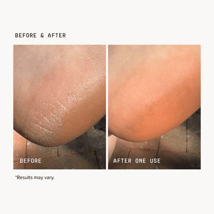 Concentrated Foot Cream